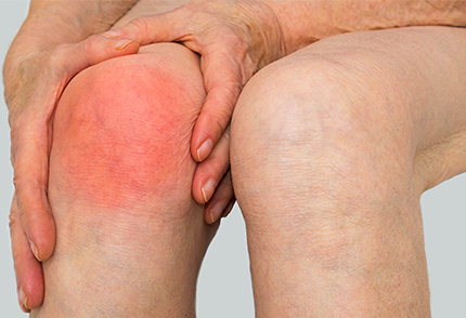 Rheumatoid Arthritis Specialist in Pune
